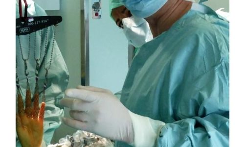 Uraz kości łódeczkowatej stanowi od 60-80 proc. wszystkich złamań kości nadgarstka