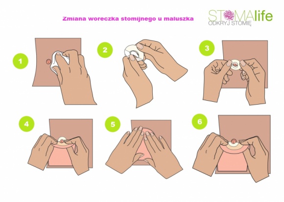 Pielęgnacja skóry maluszka ze stomią