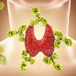 Choroba Hashimoto a dieta bezglutenowa