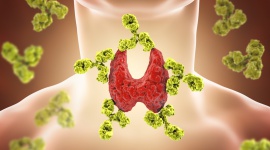 Choroba Hashimoto a dieta bezglutenowa