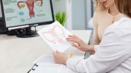 Innowacyjna ginekologia estetyczna , LIFESTYLE - Innowacyjne metody leczenia problemów intymnych kobiet