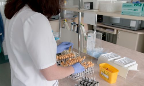 Badania laboratoryjne co możemy z nich wyczytać?