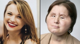Zdrowie w pakiecie