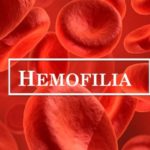 Hemofilia co wiemy o tej chorobie?