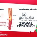 Choroby zawodowe kierowców. Jak się przed nimi ustrzec