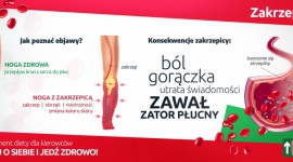 Choroby zawodowe kierowców. Jak się przed nimi ustrzec