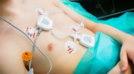 Bezkontaktowe badanie i leczenie pacjentów Zdrowie, BIZNES - System zdalnego nadzoru medycznego nad pacjentem CheckPoint Cardio przeznaczony jest głownie dla osób z zaburzeniami układu sercowo-naczyniowego i umożliwia stały monitoring jego podstawowych funkcji życiowych.